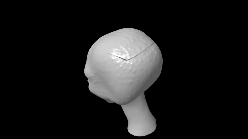 head_problem.jpg