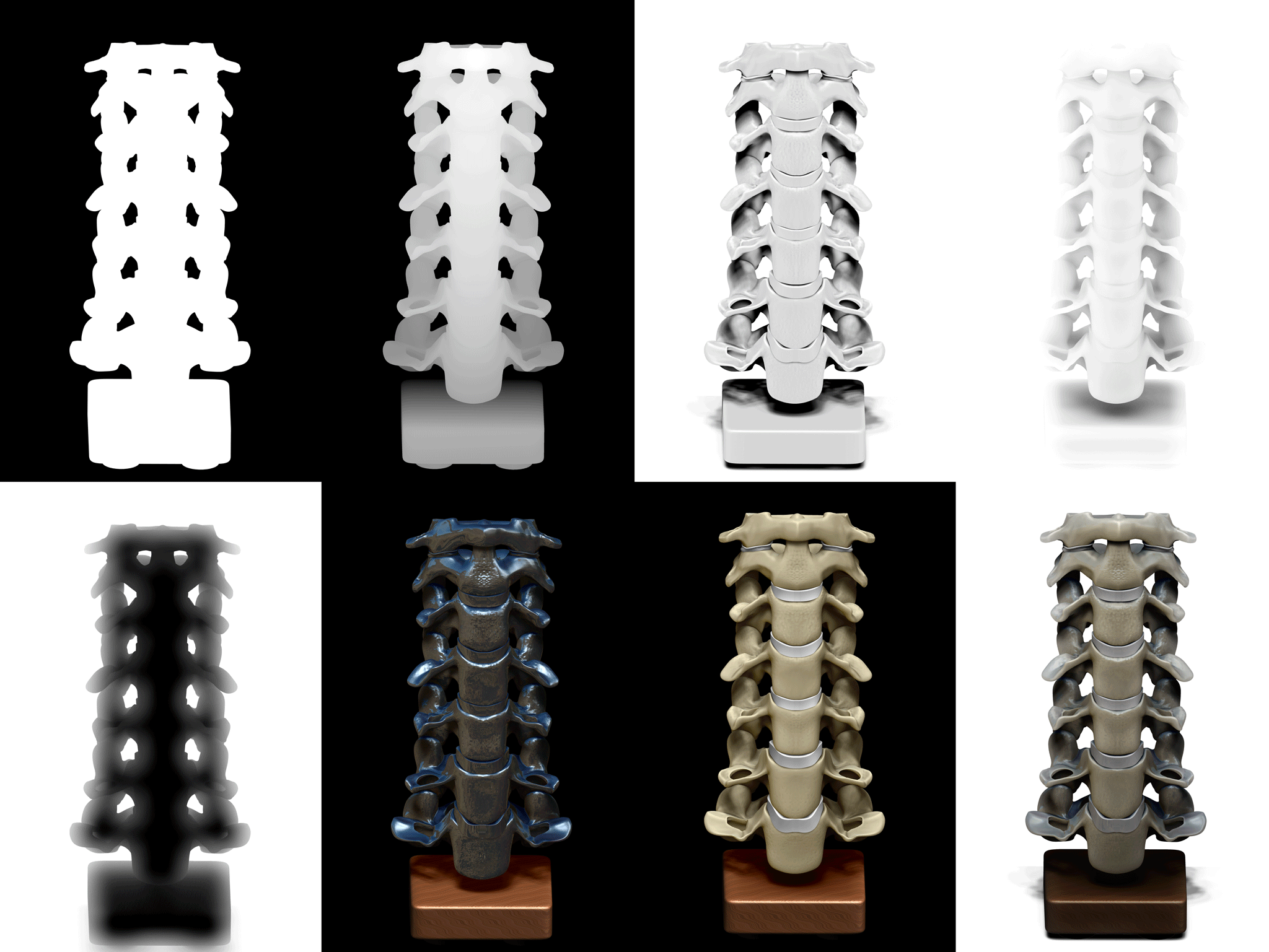 Cervical-Spine-BPR_Render-Progression.png