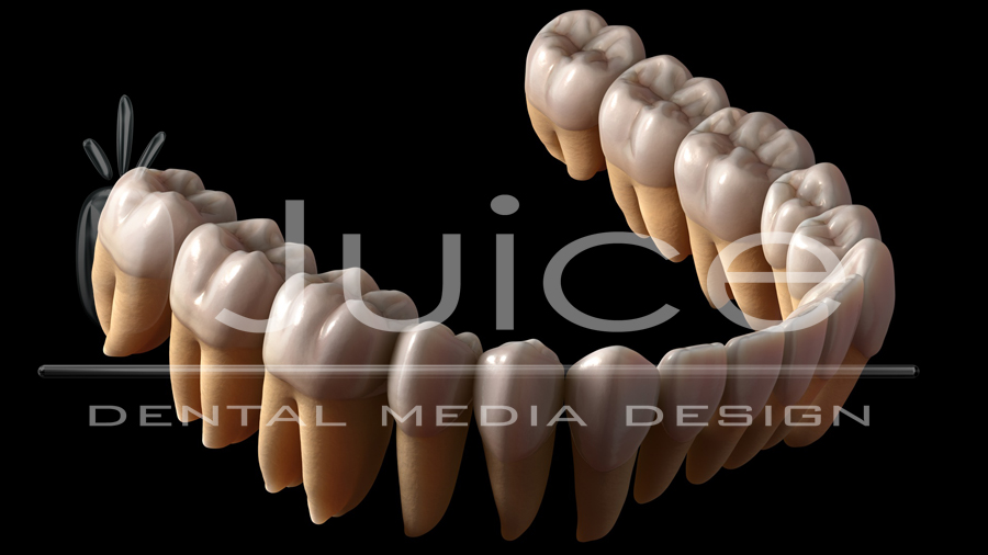 zbrush dental