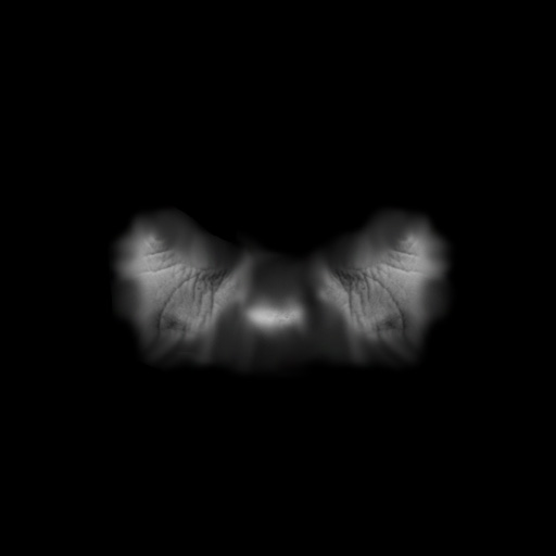 cheekWrinkles02.jpg