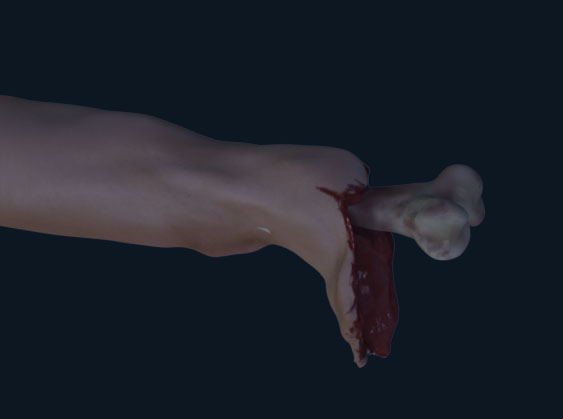 Leg_bone.jpg