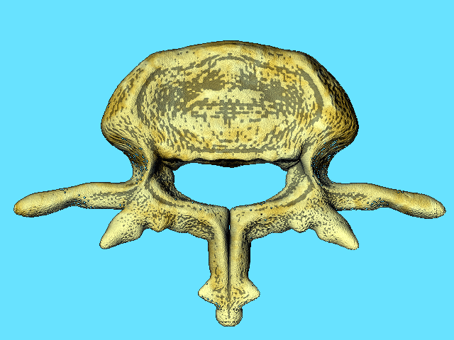 vertebra-1.gif