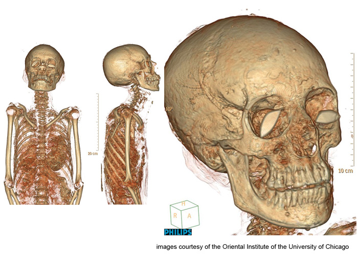 meresamun-CT-scans-1.jpg