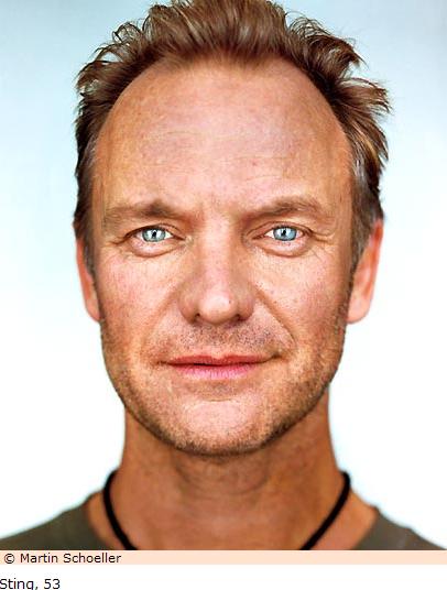 sting.JPG