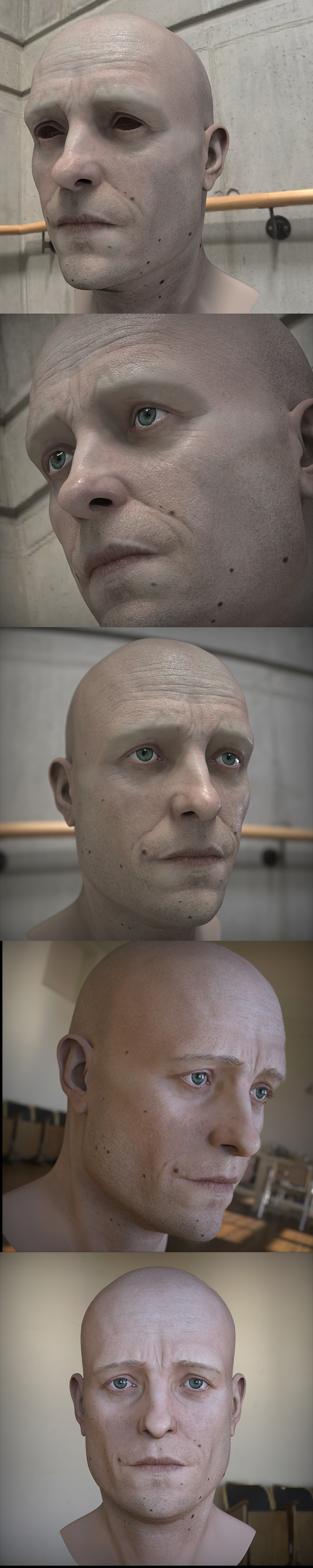 DIEHL_SKIN TEST.46