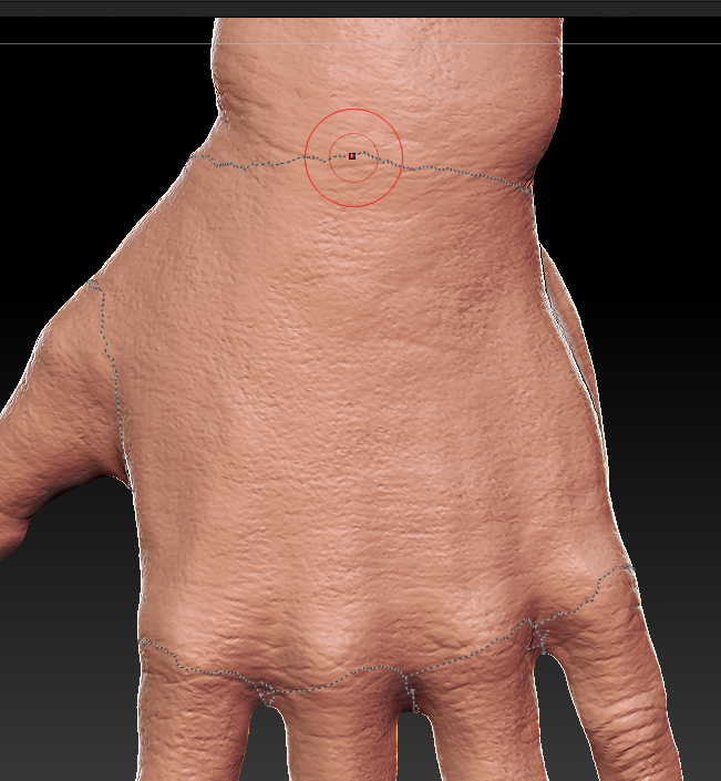 hand_problem.jpg