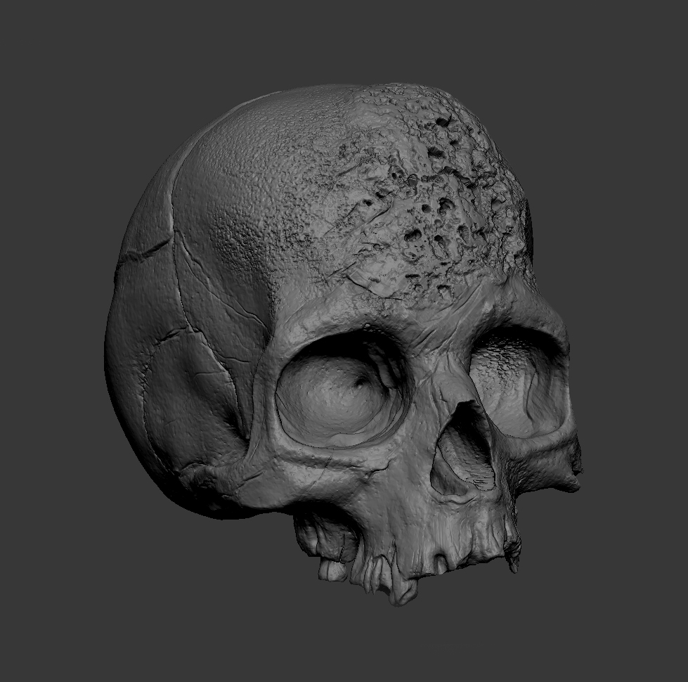 Syphilis Skull Zbrush 01.jpg