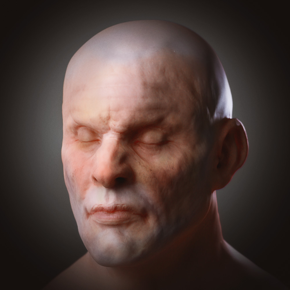 Skin2.jpg