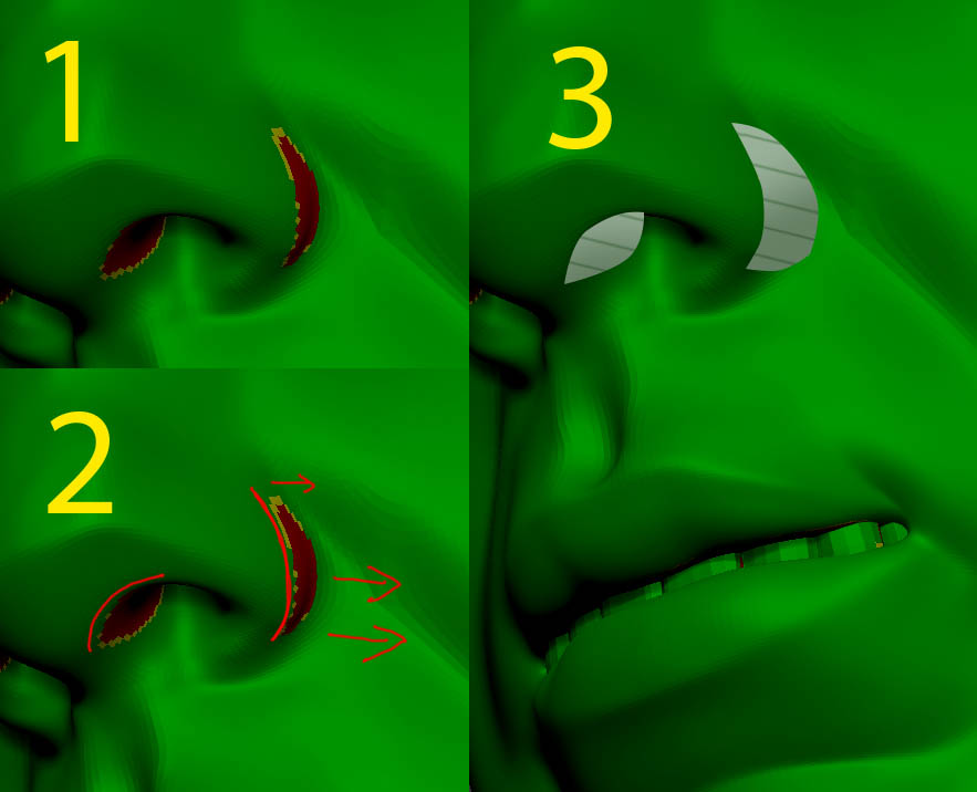 demoulding
