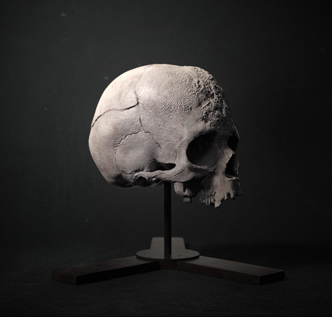 Syphilis Skull Render 02.jpg