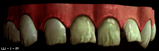 teethTest.jpg