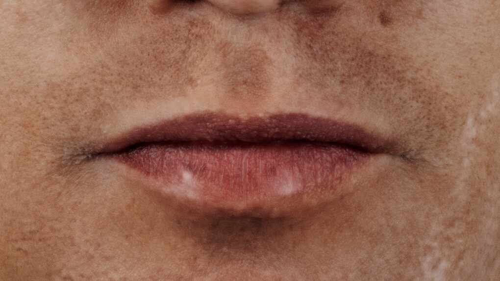 lips