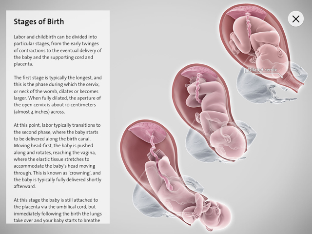 Info_Graphic_02.jpg