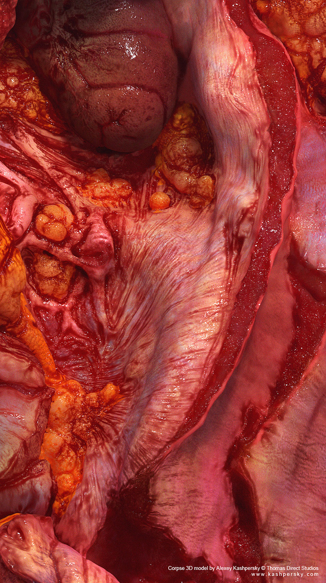 corpse_f5.jpg