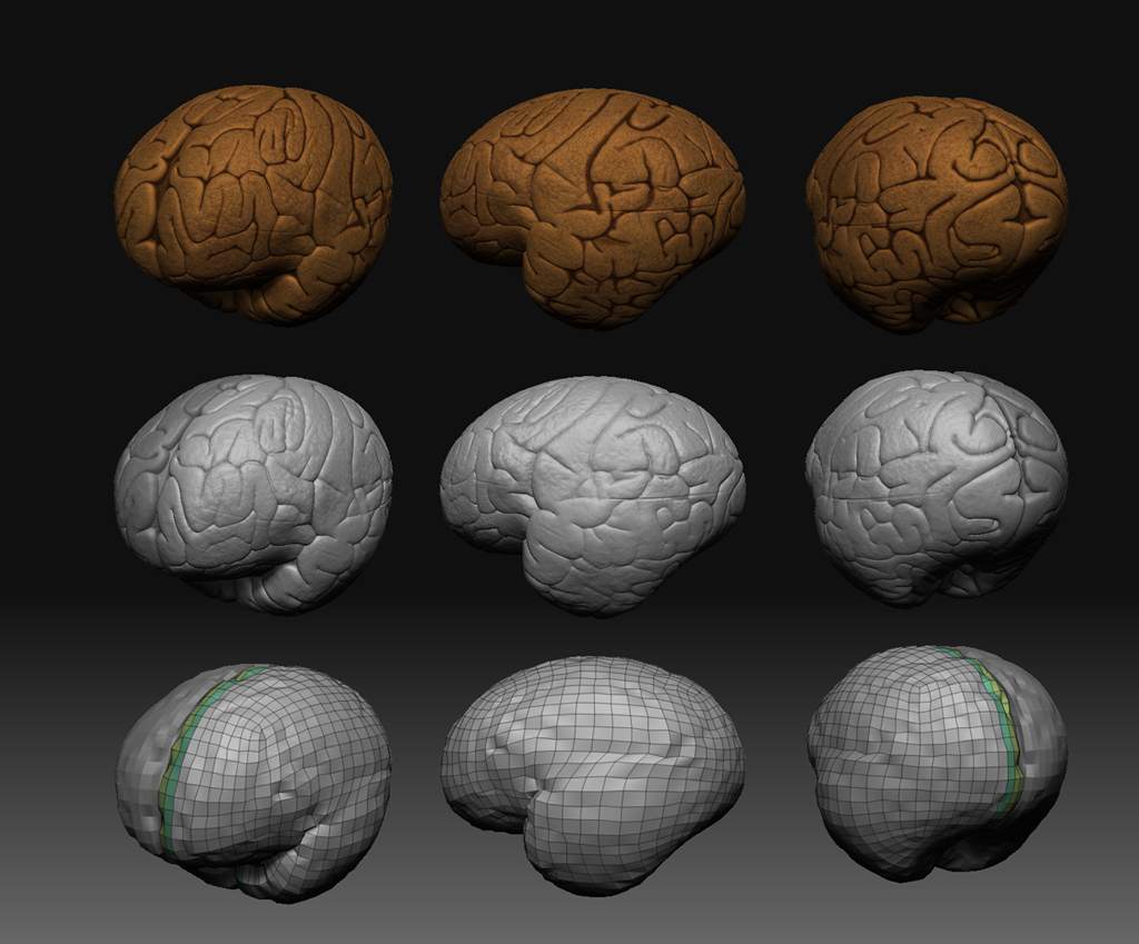 brain.jpg