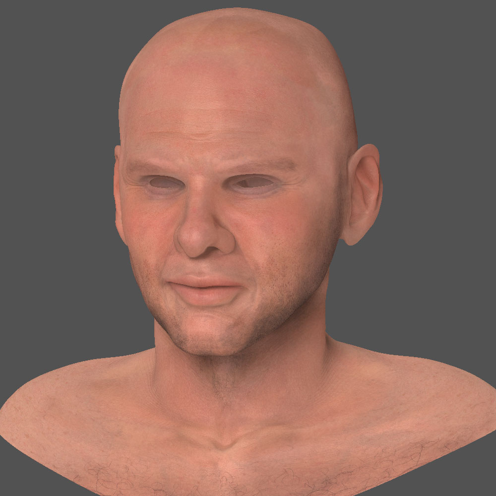 skin_3quar.jpg