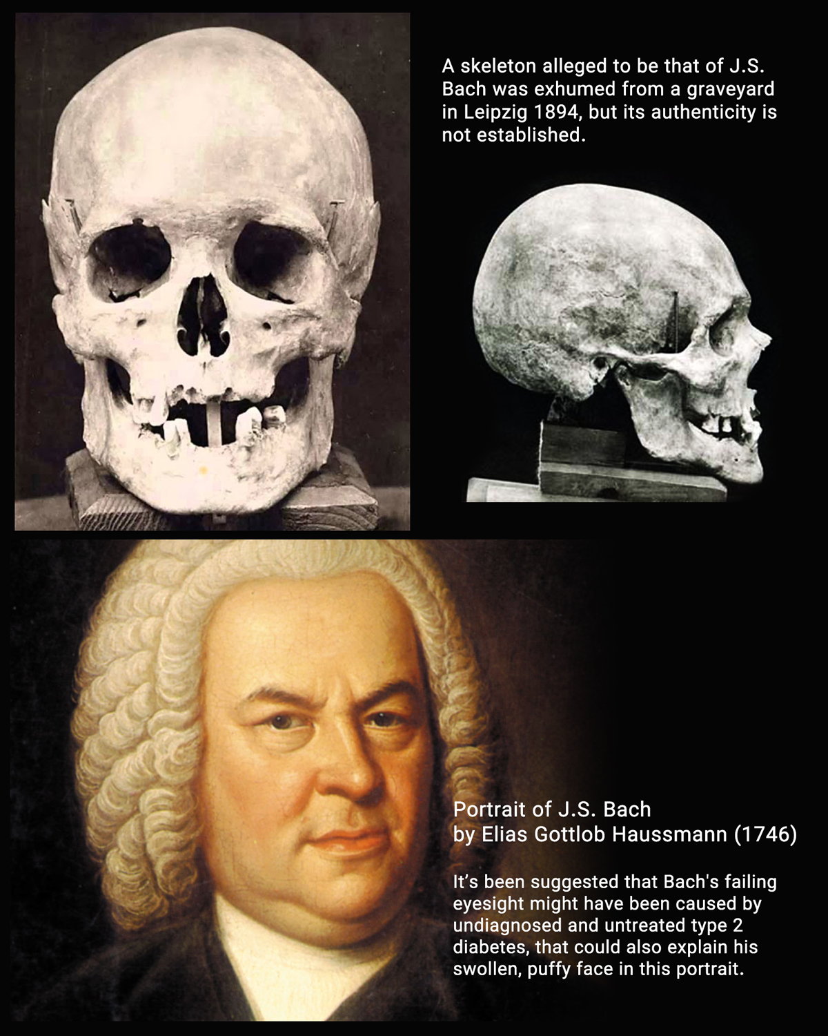 Bach-T
